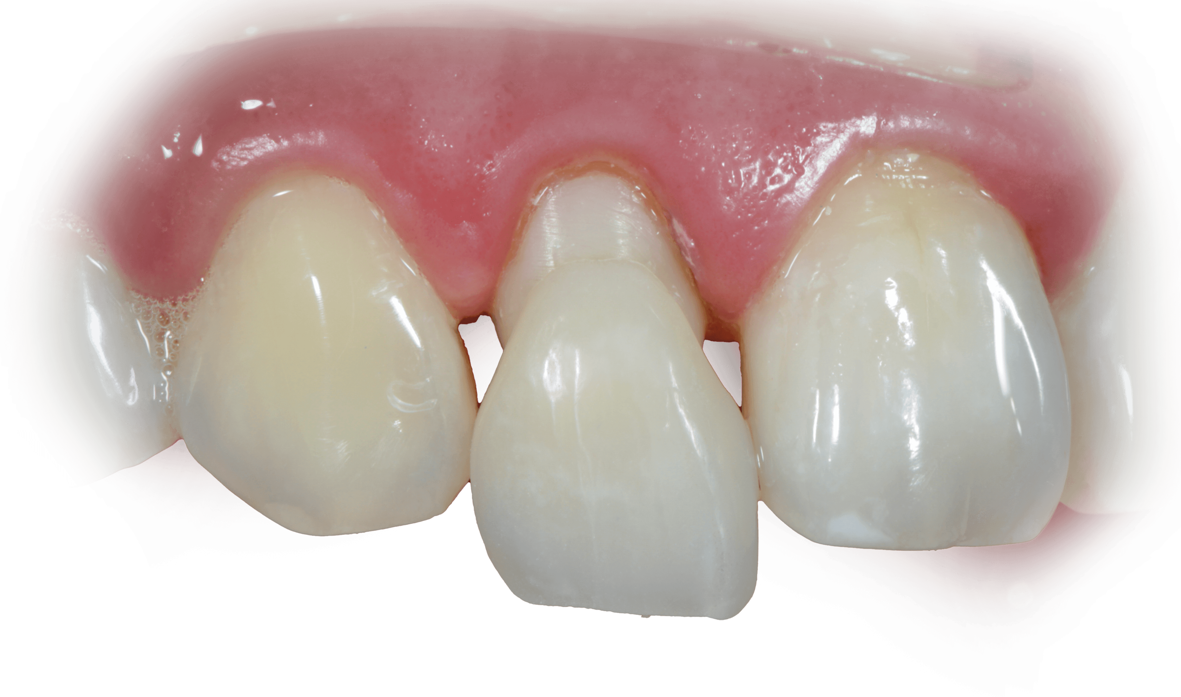 Técnica Restauradora